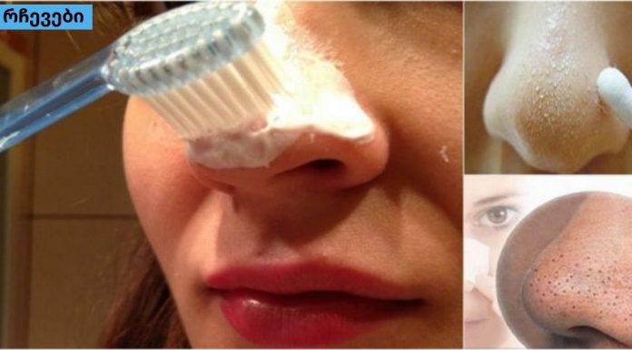 როგორ მოვიშორო შავი წერტილები მთლიანად კბილის პასტით?