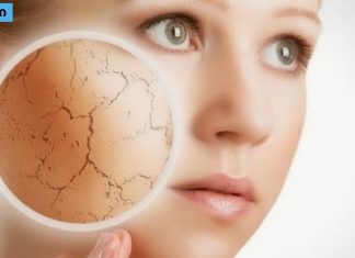 რჩევები ზამთარში კანის სიმშრალის თავიდან ასაცილებლად