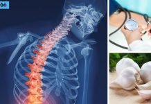 კვლევის შედეგები ! ნიორი მკურნალობს ოსტეოპოროზსა და მაღალ წნევას.