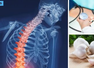 კვლევის შედეგები ! ნიორი მკურნალობს ოსტეოპოროზსა და მაღალ წნევას.