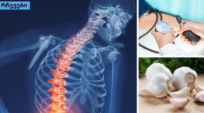 კვლევის შედეგები ! ნიორი მკურნალობს ოსტეოპოროზსა და მაღალ წნევას.