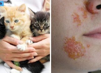 კატის მოყვარულებო,ნახეთ რა საშინელ დაავადებებს იწვევს კატის სახლში ყოფნა.კატებიდან ადამიანზე გადამდები დაავადებები