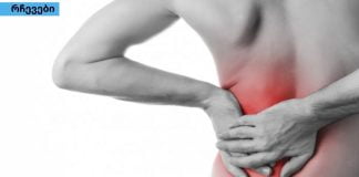 რადიკულიტის სიმპტომები და მკურნალობა ბუნებრივი მეთოდებით.