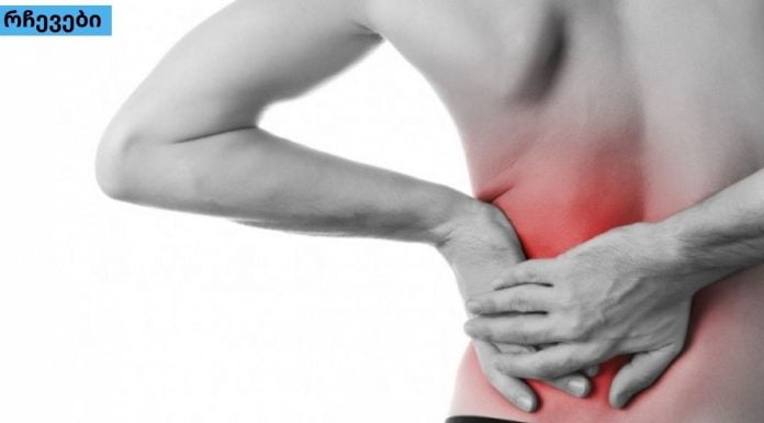 რადიკულიტის სიმპტომები და მკურნალობა ბუნებრივი მეთოდებით.