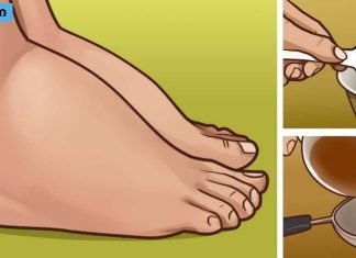 ჩემს ახლობლებს ყოველთვის შველის,სხეულის შეშუპების მიზეზები და მკურნალობის მეთოდები