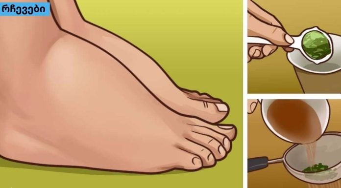 ჩემს ახლობლებს ყოველთვის შველის,სხეულის შეშუპების მიზეზები და მკურნალობის მეთოდები