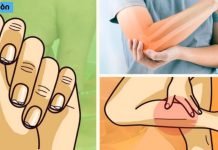 ნიშნები,რომლებიც უყურადღებოდ არ უნდა დატოვოთ.კალციუმის დეფიციტის მოულოდნელი სიმპტომები.