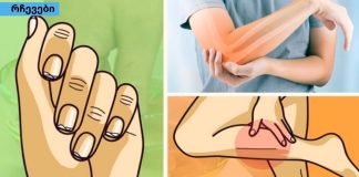 ნიშნები,რომლებიც უყურადღებოდ არ უნდა დატოვოთ.კალციუმის დეფიციტის მოულოდნელი სიმპტომები.