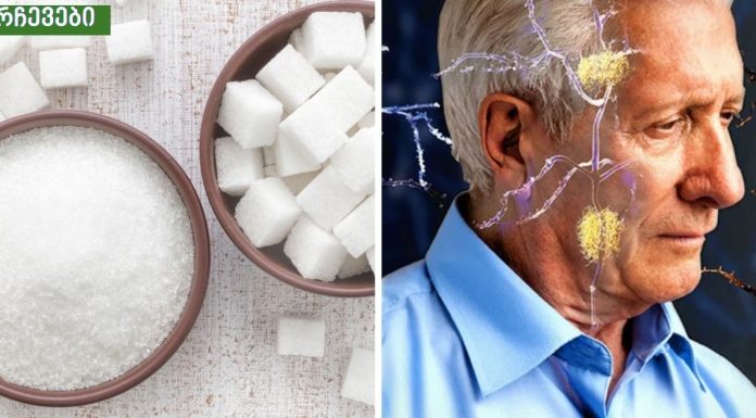 ეს საჭმელი ალცჰაიმერის(კიდურების კანკალი) რისკს 89 %-ით ზრდის! უფრთხილდით!