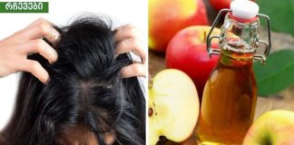 ვაშლის ძმრის 5 სარგებელი სილამაზისთვის (აკნე,ქერტლი, …..)