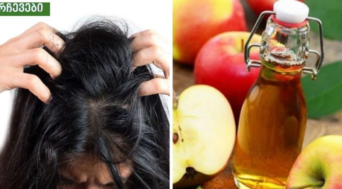 ვაშლის ძმრის 5 სარგებელი სილამაზისთვის (აკნე,ქერტლი, …..)