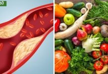 სასიცოცხლოდ მნიშვნელოვანია.როგორ შევამციროთ ქოლესტერინი ბუნებრივი გზით.