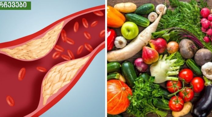 სასიცოცხლოდ მნიშვნელოვანია.როგორ შევამციროთ ქოლესტერინი ბუნებრივი გზით.