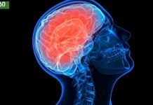 თავის ტვინის სისხლძარღვების გაწმენდა