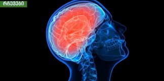 თავის ტვინის სისხლძარღვების გაწმენდა