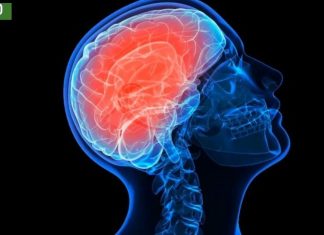 თავის ტვინის სისხლძარღვების გაწმენდა