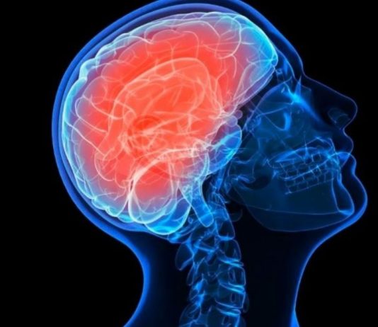 თავის ტვინის სისხლძარღვების გაწმენდა