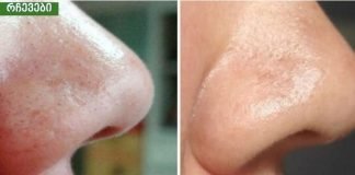 იდეალური გზა ფერიმჭამელების მოსაშორებლად. ყველაზე იაფი და ეფექური მეთოდია