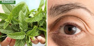 როგორ მოვიშოროთ შავი წრეები თვალების გარშემო? 3 ყველაზე ეფექტური ხერხი