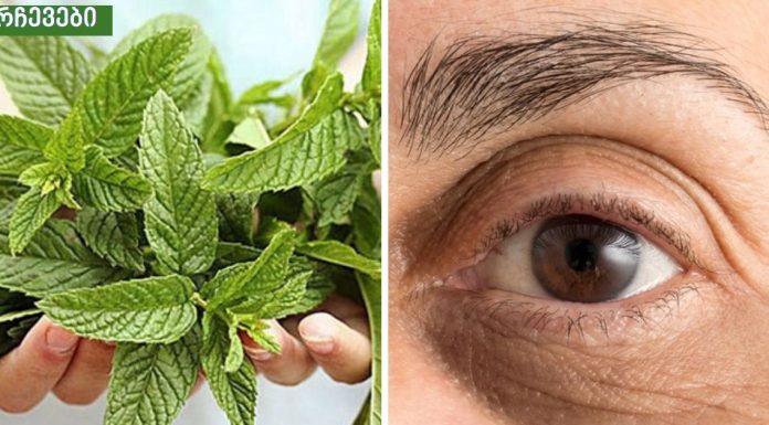 როგორ მოვიშოროთ შავი წრეები თვალების გარშემო? 3 ყველაზე ეფექტური ხერხი