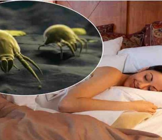 როგორ მოვაშოროთ მტვრის პარაზიტები, რომლებიც ყველას სახლში ბინადრობენ.მეც ამ მეთოდით მოვაშორე პარაზიტები.