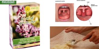 ყელის ტკივილის საუკეთესო ბუნებრივი საშუალებები