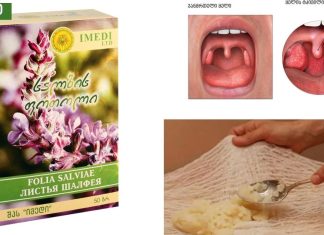 ყელის ტკივილის საუკეთესო ბუნებრივი საშუალებები