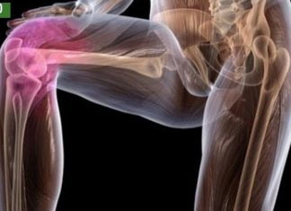 დაემშვიდობეთ ართრიტს და ტკივილს სახსრებში, კისერში, ზურგში მხოლოდ 1 ინგრედიენტით!