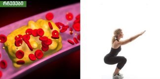 საშიში ფაქტორები, რომლებიც იწვევს გულის დაავადებას.