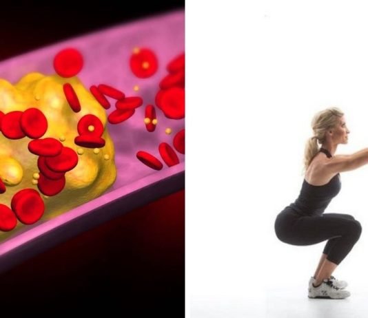 საშიში ფაქტორები, რომლებიც იწვევს გულის დაავადებას.