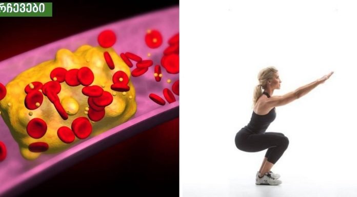 საშიში ფაქტორები, რომლებიც იწვევს გულის დაავადებას.