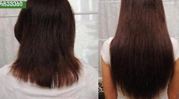 აი როგორ მოვახერხე თმის გაზრდა სახლის პირობებში! ამაში უიაფესი პროდუქტი დამეხმარა!