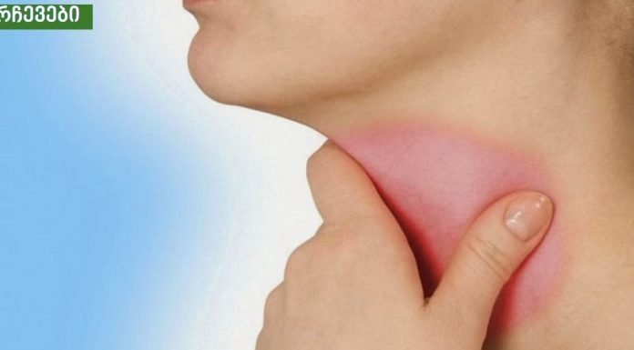 3 ინგრედიენტი, რომელიც ყელის ტკივილს ყველაზე სწრაფად გაგიქრობთ, ეს უნდა სცადოთ!