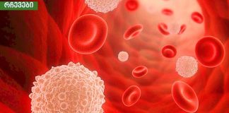 როგორ შევამციროთ ორგანიზმში შაქრის დოზა? ეს რჩევები მარტივად გახდომაში დაგეხმარებათ !