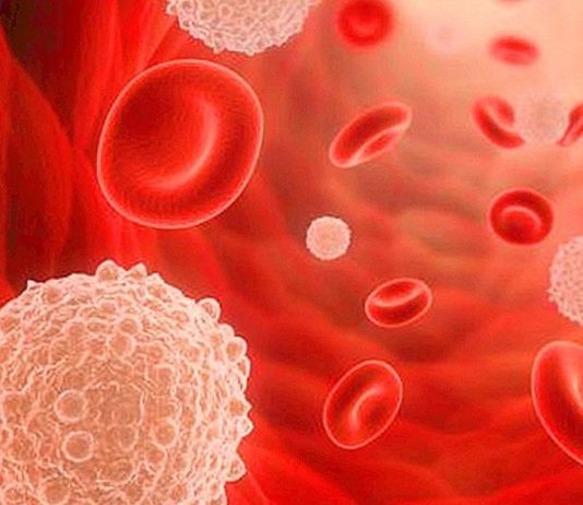 როგორ შევამციროთ ორგანიზმში შაქრის დოზა? ეს რჩევები მარტივად გახდომაში დაგეხმარებათ !