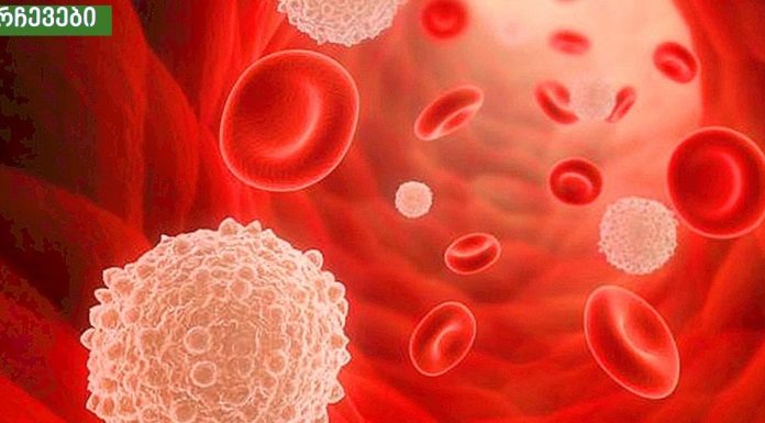 როგორ შევამციროთ ორგანიზმში შაქრის დოზა? ეს რჩევები მარტივად გახდომაში დაგეხმარებათ !