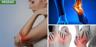 ართრიტი-სიმპტომები, მიზეზები,რომლებიც უნდა იცოდეთ სწორად რომ იმკურნალოდ,საოცარია.