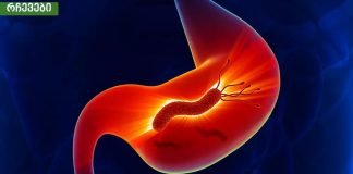 კუჭის მიკრობების სიმპტომები.მუცლის ტკივილი,პირიდან ცუდი სუნი,წონის დაკლკება,დაღლილობა.აუცილებლად გაითვალისწინეთ.