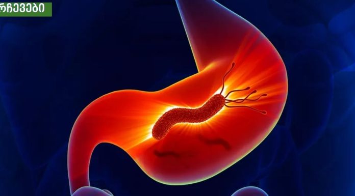 კუჭის მიკრობების სიმპტომები.მუცლის ტკივილი,პირიდან ცუდი სუნი,წონის დაკლკება,დაღლილობა.აუცილებლად გაითვალისწინეთ.