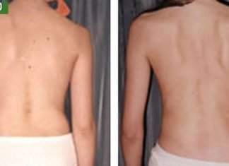 ხერხემლის ჯანმრთელობა თქვენს ხელშია!უმარტივესია.