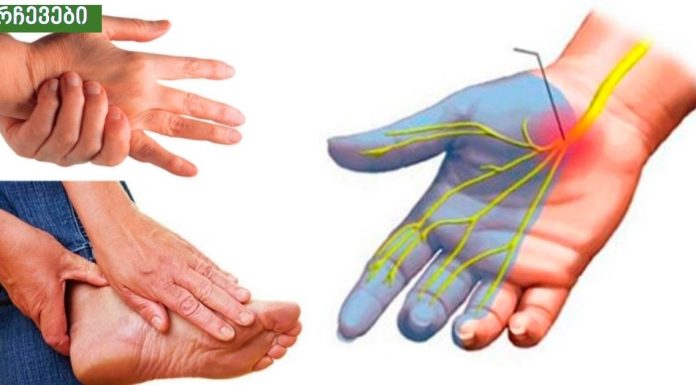 ხელების დაბუჟება.გამომწვევი მიზეზები და მკურნალობა.დიაბეტი და სტრესი .