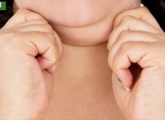 როგორ მოვიშოროთ ჭარბი ცხიმი სახიდან და კისრიდან? ყველაზე სასარგებლო რჩევები