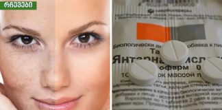 სუქცინის მჟავა ძალიან ეფექტურია პიგმენტაციისა და ნაოჭებისთვის