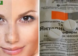 სუქცინის მჟავა ძალიან ეფექტურია პიგმენტაციისა და ნაოჭებისთვის