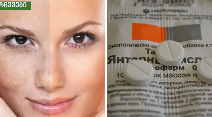 სუქცინის მჟავა ძალიან ეფექტურია პიგმენტაციისა და ნაოჭებისთვის