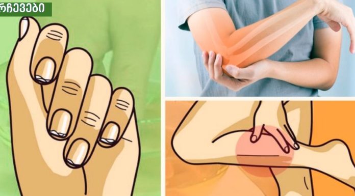 სანამ ამას გავიგებდი ყველაფერი მტკიოდა,ეს ყოფილა სასწაული,კალციუმის დეფიციტის მოულოდნელი სიმპტომები.