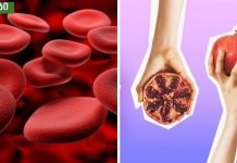 ყველაზე მეტად დაბალი ჰემოგლობინის მეშინია,მივაგენი მასთან გამკლავების საუკეთესო მეთოდებს.