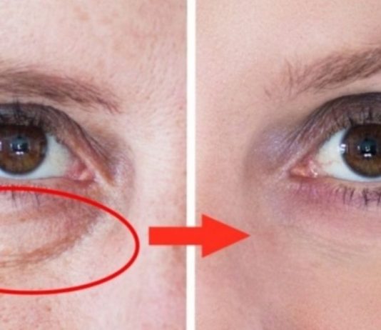 4 მცდარი წარმოდგენა დაბერების საწინააღმდეგო კრემების შესახებ