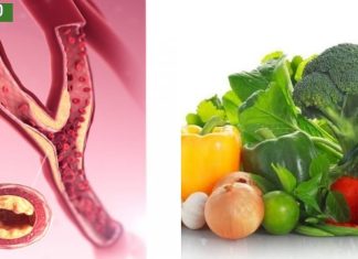 მე ამით ,ჩემს საყვარელ ადამიანებს გადავარჩენ უეცარი სიკვდილისგან, როგორ გავწმინდოთ არტერიები საკვებით.