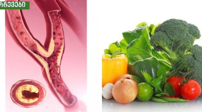 მე ამით ,ჩემს საყვარელ ადამიანებს გადავარჩენ უეცარი სიკვდილისგან, როგორ გავწმინდოთ არტერიები საკვებით.